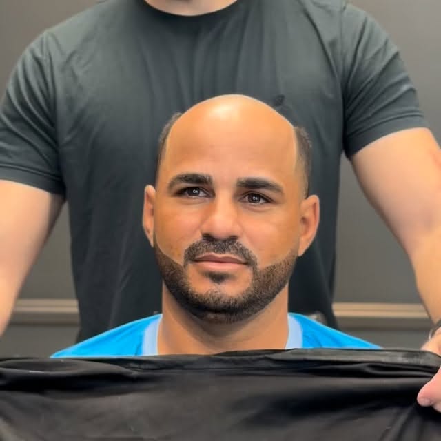 Mais do que cabelo, é confiança de volta!
A prótese capilar não transforma apenas a aparência, ela r