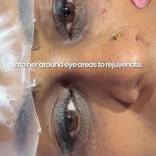 Say goodbye to tired-looking eyes. ✨ 

Our advanced under-eye rejuvenation treatment is enriched wit