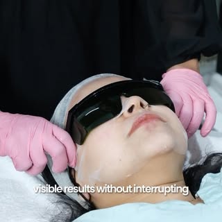 Glow brighter with Green Glow by BioRePeel ✨ 

Experience advanced skin resurfacing that helps revea