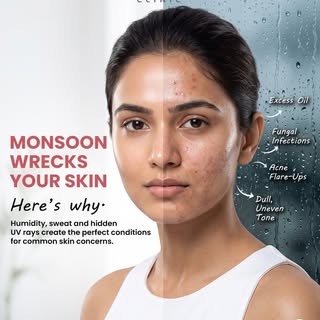 Monsoon may change the weather, but it shouldn’t change your skin. 🌧️✨ 

Keep your skin healthy, hy