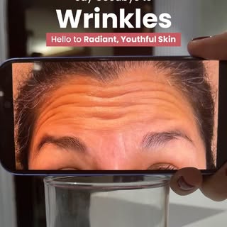 Fine lines don’t have to stay forever. ✨

At Siwatch Clinic, our advanced aesthetic treatments help 