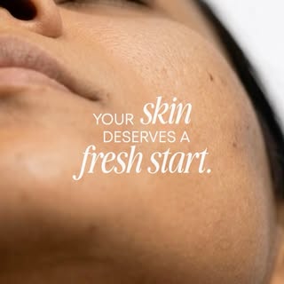 Reveal smoother, healthier looking skin with Microneedling. 

✨ This advanced treatment helps reduce