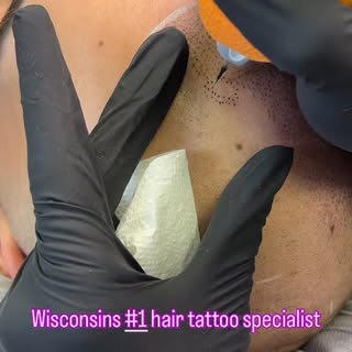 Summer is round the corner!  Let’s free you from the caps and fibers!! Book with us and we guarantee