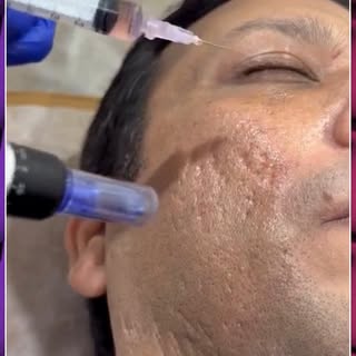 ✨ Refresh Your Skin. Restore Your Glow.

Healthy, radiant skin starts with the right care. Our advan