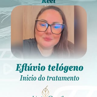 Depois da cirurgia eu já sabia que poderia acontecer eflúvio telógeno, uma queda de cabelo comum apó