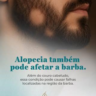 Você sabia que a Alopecia Areata também pode afetar a barba?

Essa condição autoimune acontece quand