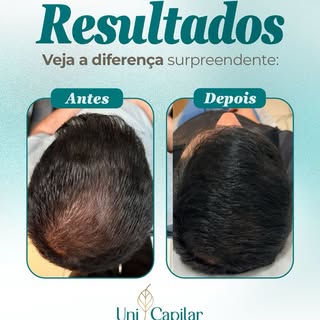 ✨ Resultados reais são construídos com ciência, estratégia e acompanhamento.

Muitas pessoas procura