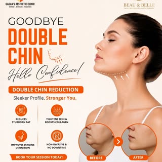 Say goodbye to your double chin and hello to a more defined, confident profile! 💫
Achieve a slimmer