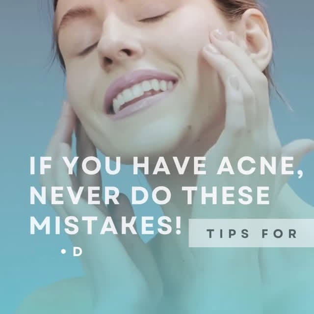 🚨SERIES: Acne & Acne marks - all you need to Know about acne. Acne may go, but the marks stay??!! D
