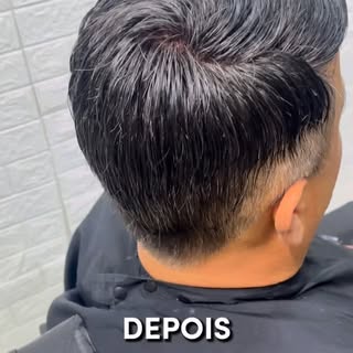 Prótese capilar masculina e feminina. 
Se você é calvo, sofre com a alopecia ou quer mudar o visual,