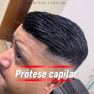 A prótese capilar é exatamente o que você precisa.
Algo que elimine sua calvície, te traga mais auto