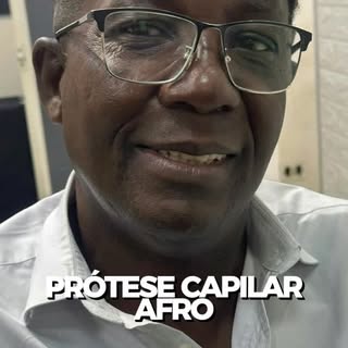 Prótese capilar afro! 
Top demais! 🔝

#Suzano #protesecapilar #calvicie #protesecapilarmasculina