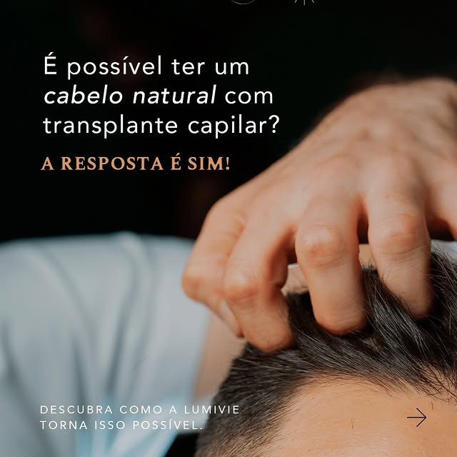 Na Lumivie, utilizamos a técnica FUE para garantir que seu transplante capilar seja discreto, eficaz