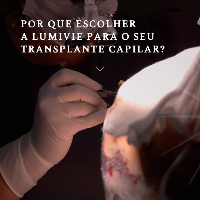 Na Lumivie, não oferecemos apenas um transplante capilar – oferecemos a garantia de um procedimento 