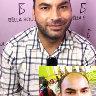 Are You Happy With Your Hair Transplant?

Here is our patient answer.

Meet our satisfied patient, w