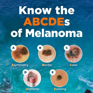 Melanoma Monday 🖤 One of the simplest ways to protect your skin is knowing what to look for. Rememb