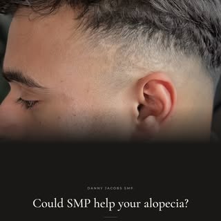 Alopecia affects around 2% of the global population. For many, it’s something they’ve quietly dealt 
