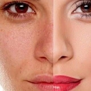 Transform your dull skin into healthy and glowing skin. 
Personalize your treatment #hydrafacial #ch