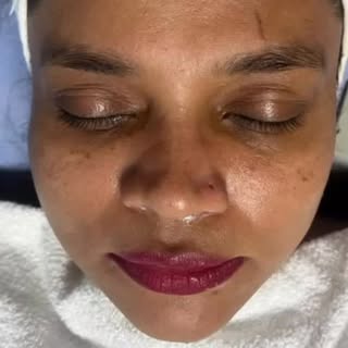 Reveal healthier, brighter skin with our customized Medifacial treatment. ✨ Book your glow session t