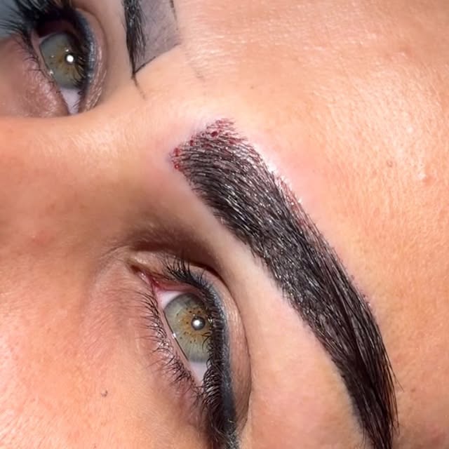 ⁨	این نتیجه فقط پر کردن ابرو نیست؛
ساختن ابرویی از صفره🤩
مشاوره ورزرو وقت: 09120719901
#میکروکاشت #