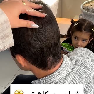 ۸ماه بعد کاشتمو🤩🤩🤩
مشاوره و رزرو وقت: 09120719901

#کاشتمو #کاشتموطبیعی #کاشت_مو #کاشت_مو_آقایان 