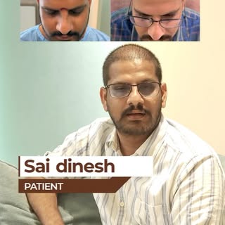 Here’s our hair transplant patient, Sai Dinesh, sharing his honest experience and treatment journey 