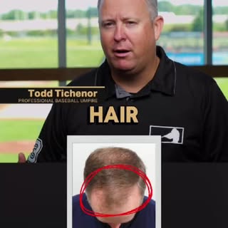 MLB umpire Todd Tichenor did his research and chose @Restore_Hair for their leading edge FUE technol