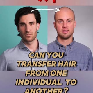 It is a common question and Dr. Harris at @Restore_Hair has the answer. Hair grafts behave just like