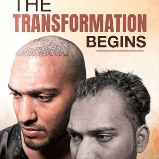 From an Instagram scroll to a life changing transformation. 

He first discovered New Roots on Insta