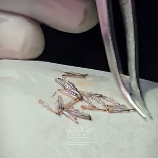 बालों की हर एक जड़ को बड़ी सावधानी और सटीकता के साथ One by One Implant किया जाता है, ताकि परिणाम पूर