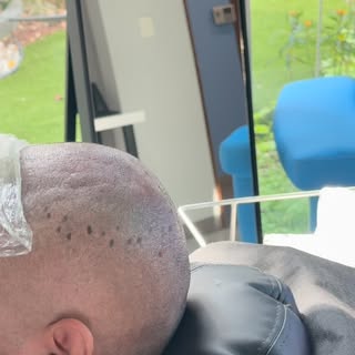 Deja tu confianza en nuestras manos y anímate a iniciar con tu tratamiento de micropigmentación capi