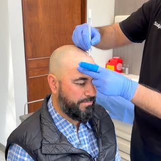 Es Scalpworks realizamos diseños 100% personalizados encontrando las medidas perfectas y el tono ide