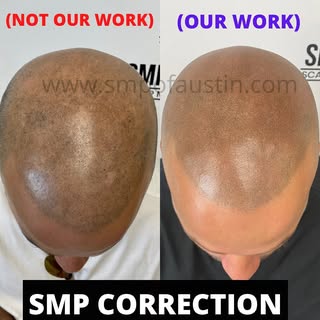 This client came in with blue/green and blown out impressions from another clinic. We blended the im