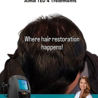 We know what happens here! Clients are seeing new growth, they are seeing hairloss stabilize and hai