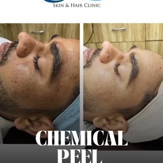 Expert care .visible results.
 Because you are deserve the best !🦋✨
