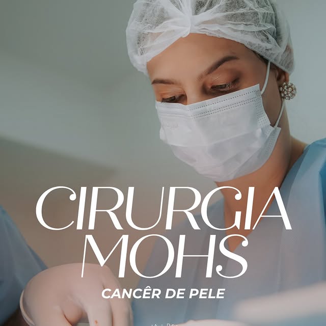 Você sabe por que a Cirurgia Micrográfica de Mohs é considerada o padrão-ouro para tratar alguns tip