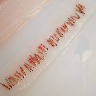 Implanting the grafts is a long process that requires a lot of attention to detail. 👩‍⚕️ Our team i