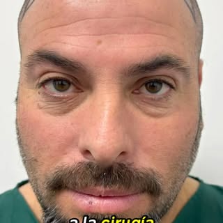 Transplante de sobrancelha na YourMed

Morar no Guarujá não impediu a Mariana de realizar o sonho de