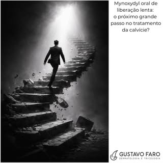 MYNOXYDYL ORAL DE LIBERAÇÃO LENTA: O PRÓXIMO GRANDE PASSO NO TRATAMENTO DA CALVÍCIE?

É inegável e i