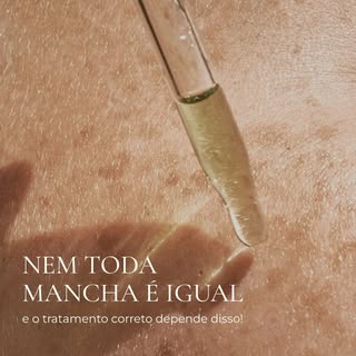 Nem toda mancha é igual, e o tratamento adequado depende justamente de entender isso.

Dra. Irene Pe