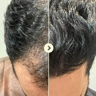 Resultados que transformam e renovam a confiança.

Antes e depois de muito cuidado, técnica e acompa