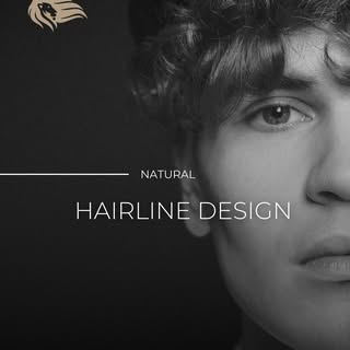 Natural hairlines are never accidental.
They are the result of medical expertise and precise design.