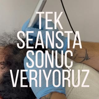 Türkiye’nin ilk marka tescilli saç simülasyon merkezi Hfs Center ‘a hoşgeldiniz. 14 yıllık tecrübemi
