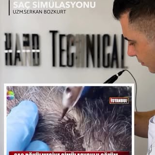 Türkiye’nin ilk marka tescilli saç simülasyon merkezi Hfs Center ‘a hoşgeldiniz. 14 yıllık tecrübemi