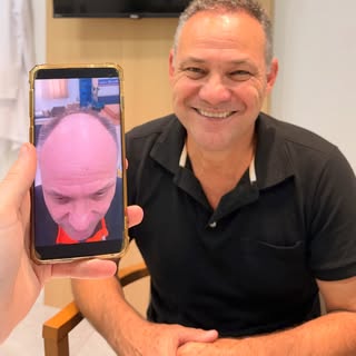 O sorrisão diz tudo! 😁

Com apenas 6 meses de pós-operatório, a transformação já é evidente. E o me