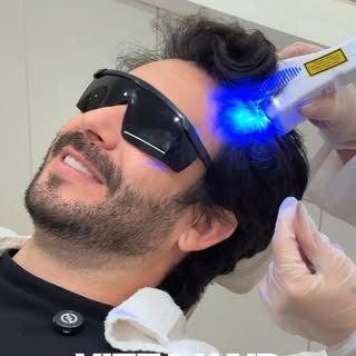 O @italoventura esteve aqui na clínica para sessão de Vitta Hair, nosso microagulhamento com blend d