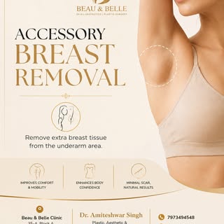 Accessory breast tissue is a common cause of persistent underarm fullness and bulging.

Also known a
