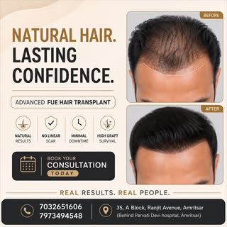 ✨ Natural Hair. Expert Hands. Trusted Care.

Hair restoration is more than just replacing lost hair—
