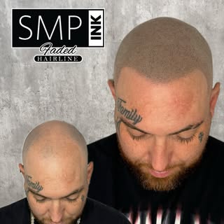 Receding? Thinning? Patchy? Say goodbye to the struggle. Scalp Micropigmentation (SMP) gives you the