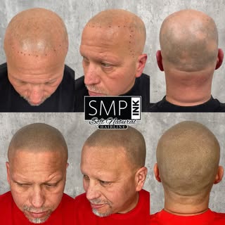 It doesn’t take much to see the results. just look at this transformation! 🔥 From patchy and thinni